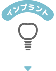 icon_for_service07_implant